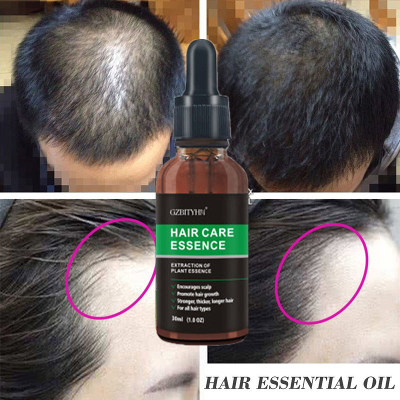 Hair Growth Oil Hair Growth Oil Oem Hair Care Essential Oil Beauty Supplies