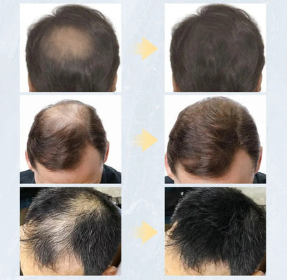 Toppik Hair Building Fibres Powder 27.5g Beauty Supplies